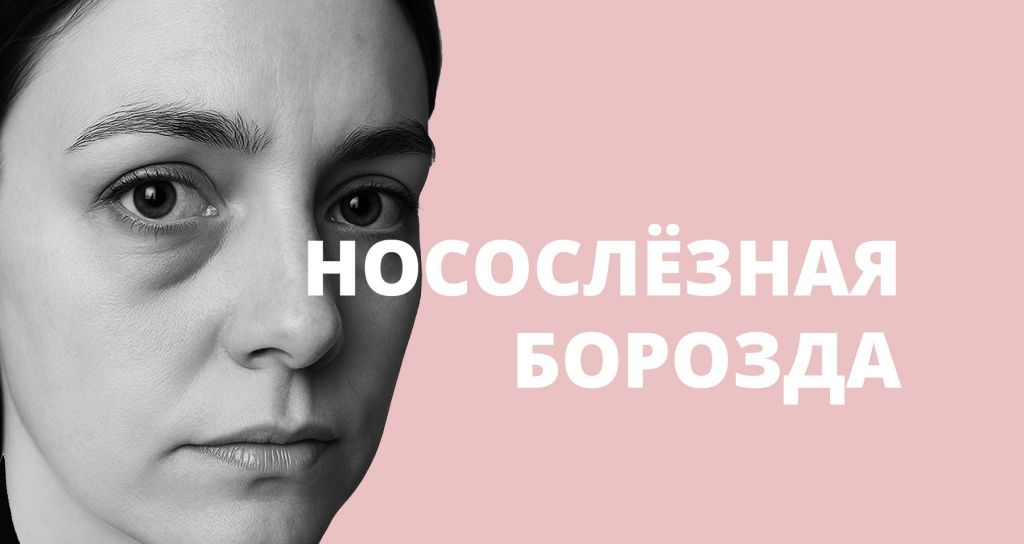 Впадины под глазами