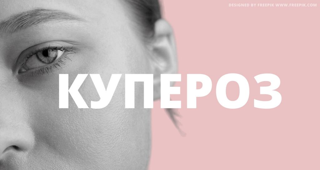 Купероз