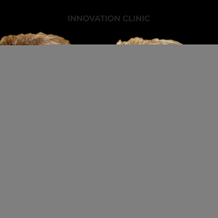 Нитевой лифтинг лица фото до и после 1