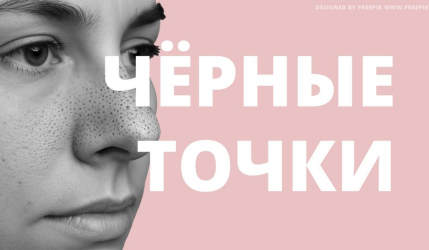 Как избавиться от черных точек