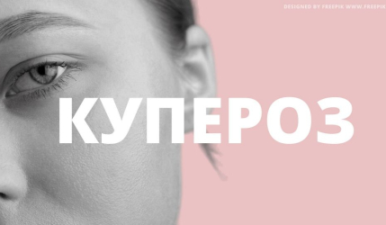Купероз